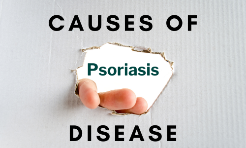 Causes of Psoriasis Disease