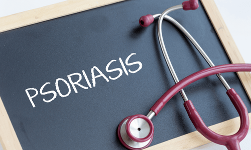 How to Treat Psoriasis Effectively - Oleum Cottage